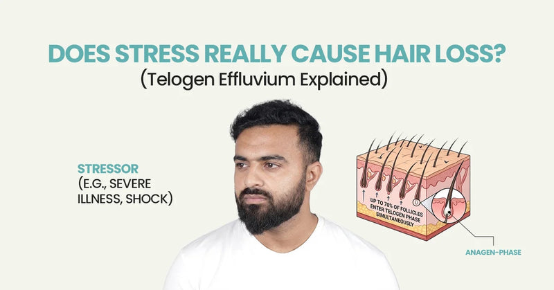 Does Stress Really Cause Hair Loss?