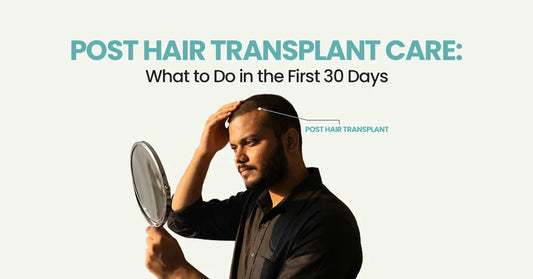 Post Hair Transplant Care: What to Do in the First 30 Days