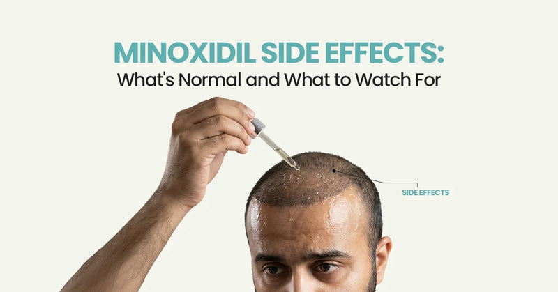 Minoxidil Side Effects: What's Normal and What to Watch For
