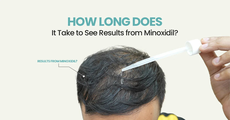 How Long Does It Take to See Results from Minoxidil