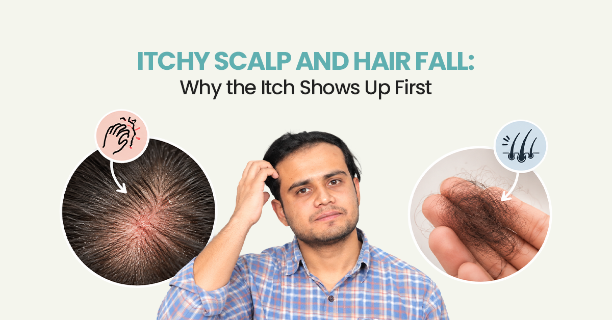 Itchy Scalp and Hair Fall: Why It Happens & What to Do – URoots