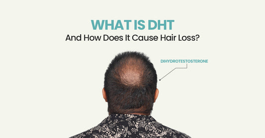 What Is DHT and How Does It Cause Hair Loss?