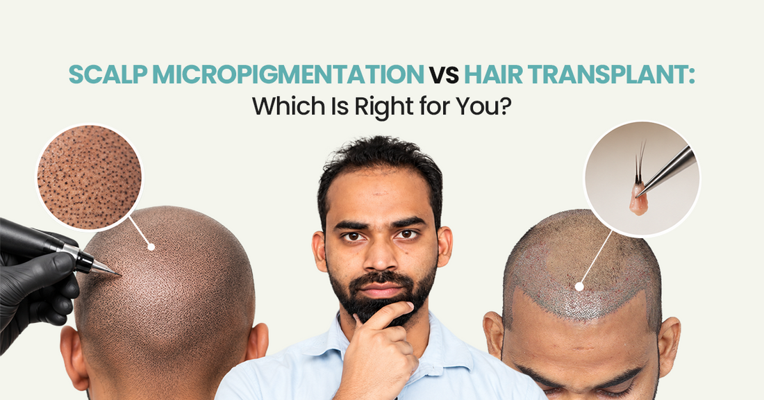 Scalp Micropigmentation vs Hair Transplant: Which Is Right for You?