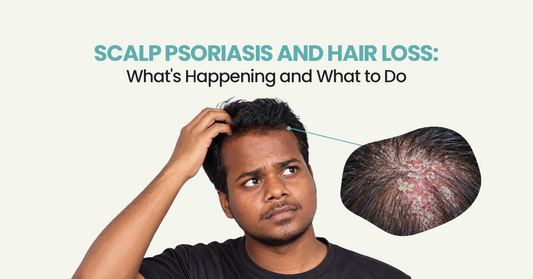 Scalp Psoriasis and Hair Loss: What's Happening and What to Do
