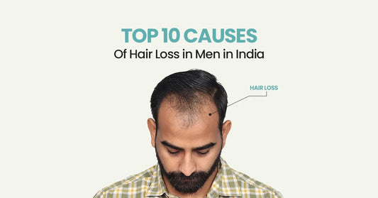 Top 10 Causes of Hair loss In Men