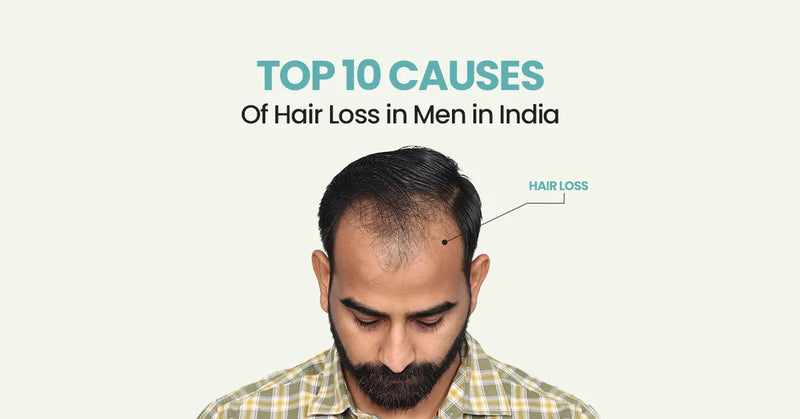Top 10 Causes of Hair loss In Men