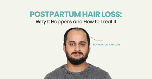 Postpartum Hair Loss: Why It Happens and How to Treat It