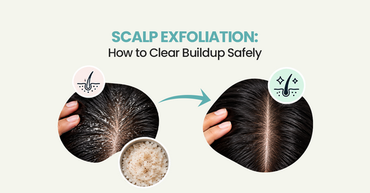 Scalp Exfoliation: How to Clear Buildup Safely