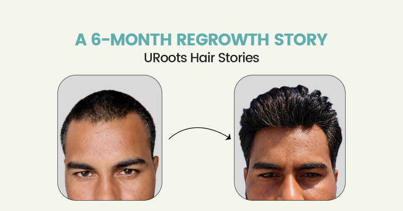 A 6-Month Regrowth Story | URoots Hair Stories