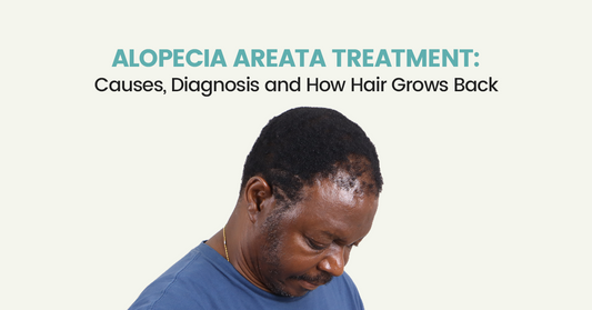 Alopecia Areata Treatment: Causes, Diagnosis and How Hair Grows Back
