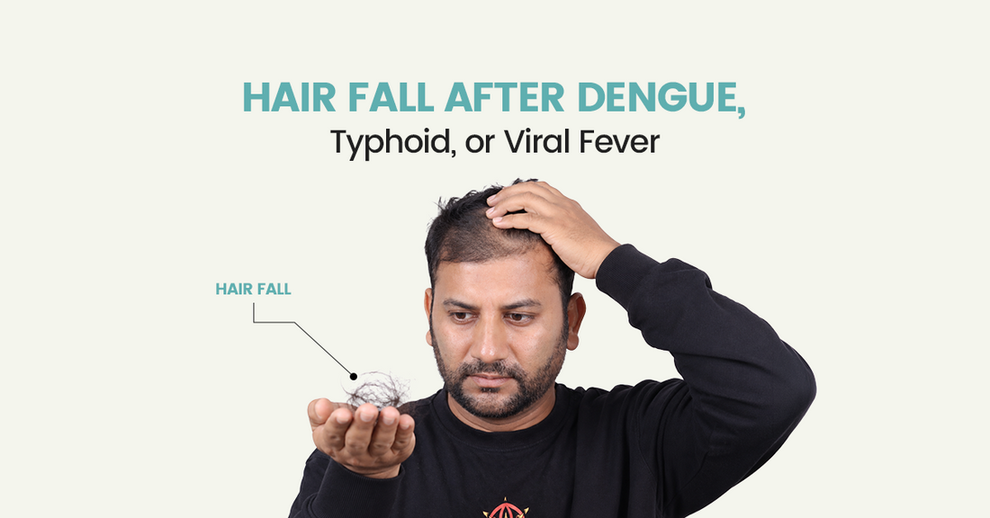Hair Fall After Dengue, Typhoid, or Viral Fever