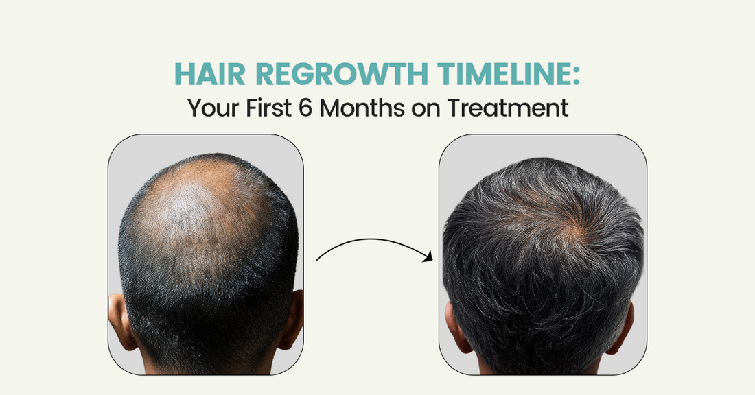 Hair Regrowth Timeline: Your First 6 Months on Treatment