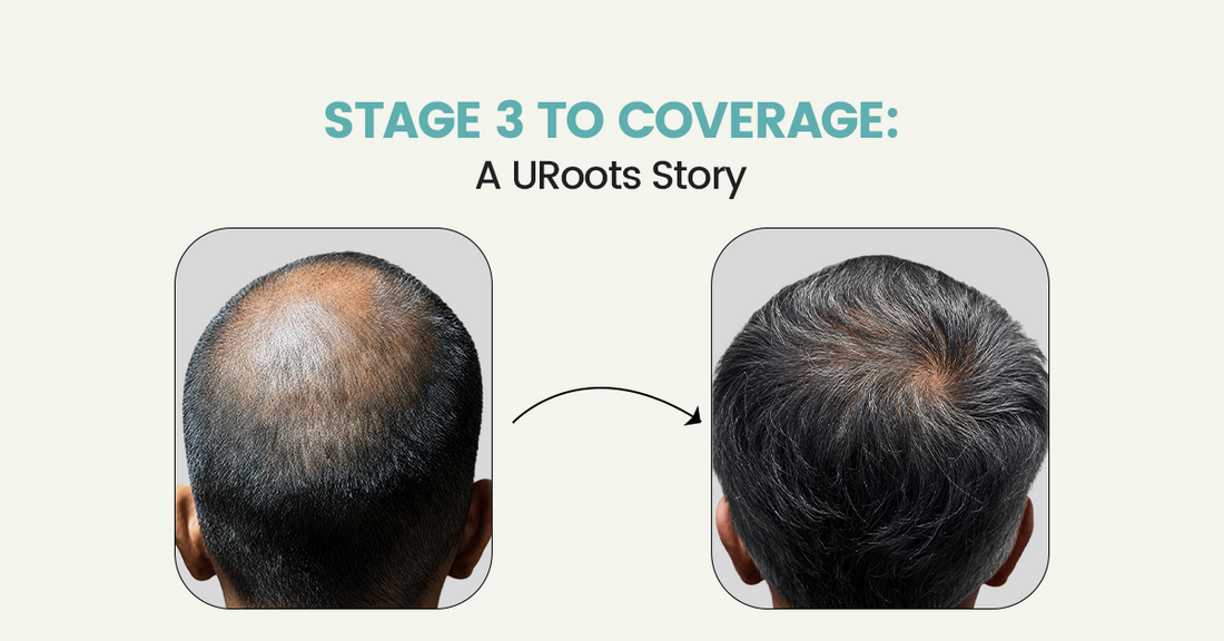 Stage 3 to Coverage: A URoots Story