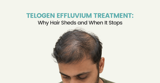 Telogen Effluvium Treatment: Why Hair Sheds and When It Stops
