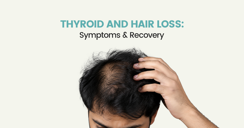 Thyroid and Hair Loss: Symptoms & Recovery