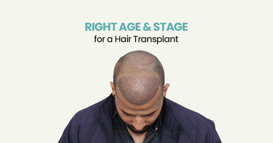 Right Age & Stage for a Hair Transplant