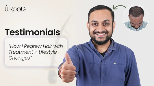 A "before and after" testimonial showing visible hair regrowth and improved density at the crown following clinical treatment at QHT Clinic.