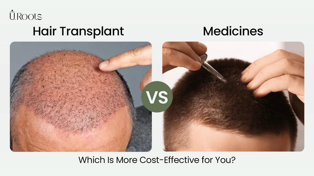 Hair Transplant vs Medicines: Which Is More Cost-Effective for You?