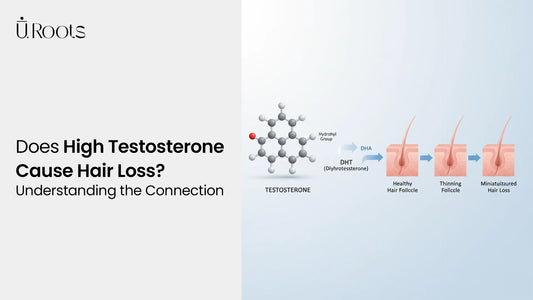 Illustration showing the impact of DHT on hair follicles, highlighting the process of follicle miniaturization and hair thinning caused by high testosterone.