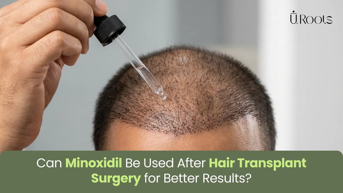A close-up view of a person using a dropper to apply minoxidil solution to their scalp following hair transplant surgery to improve growth results.