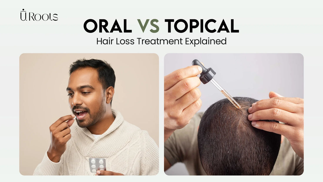 Oral vs topical hair loss treatment explained – URoots hair regrowth solutions