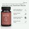 Gentle Gut Daily Probiotic Wellness Supplement | Digestive & Immunity Support | URoots